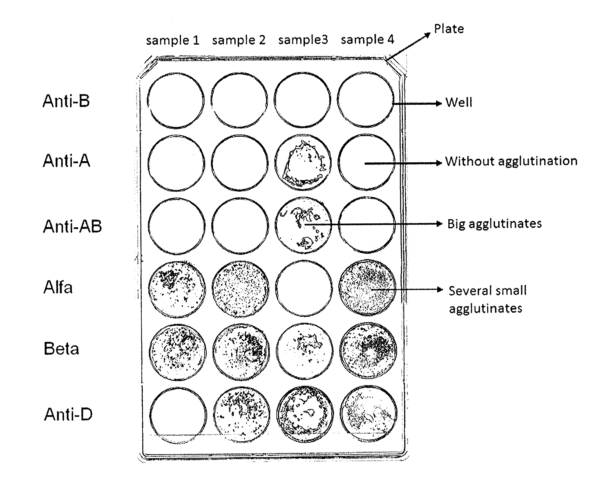 Method for analyzing image data relating to agglutination assays