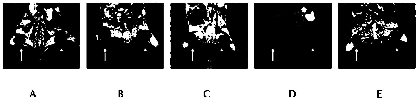 Preparation method of antibody-mediated optomagnetic double-mode meso-porous silicon nanoparticles