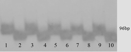 Molecular marker of maize high lysine gene zmcytmdh4 and its application