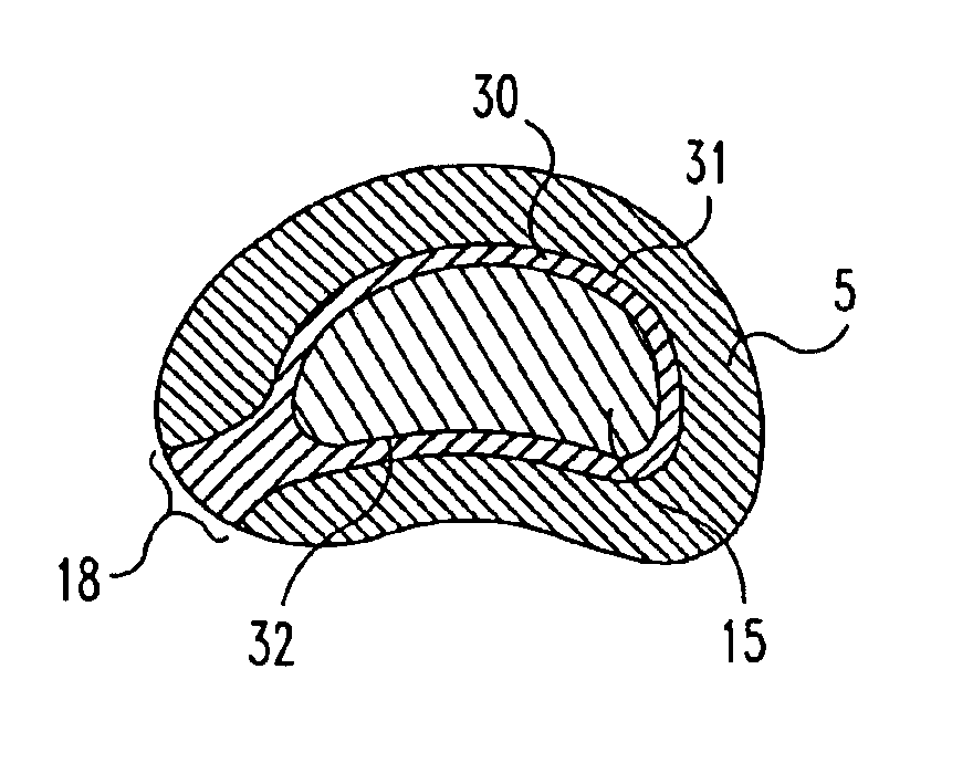 Intervertebral disc nucleus implants and methods