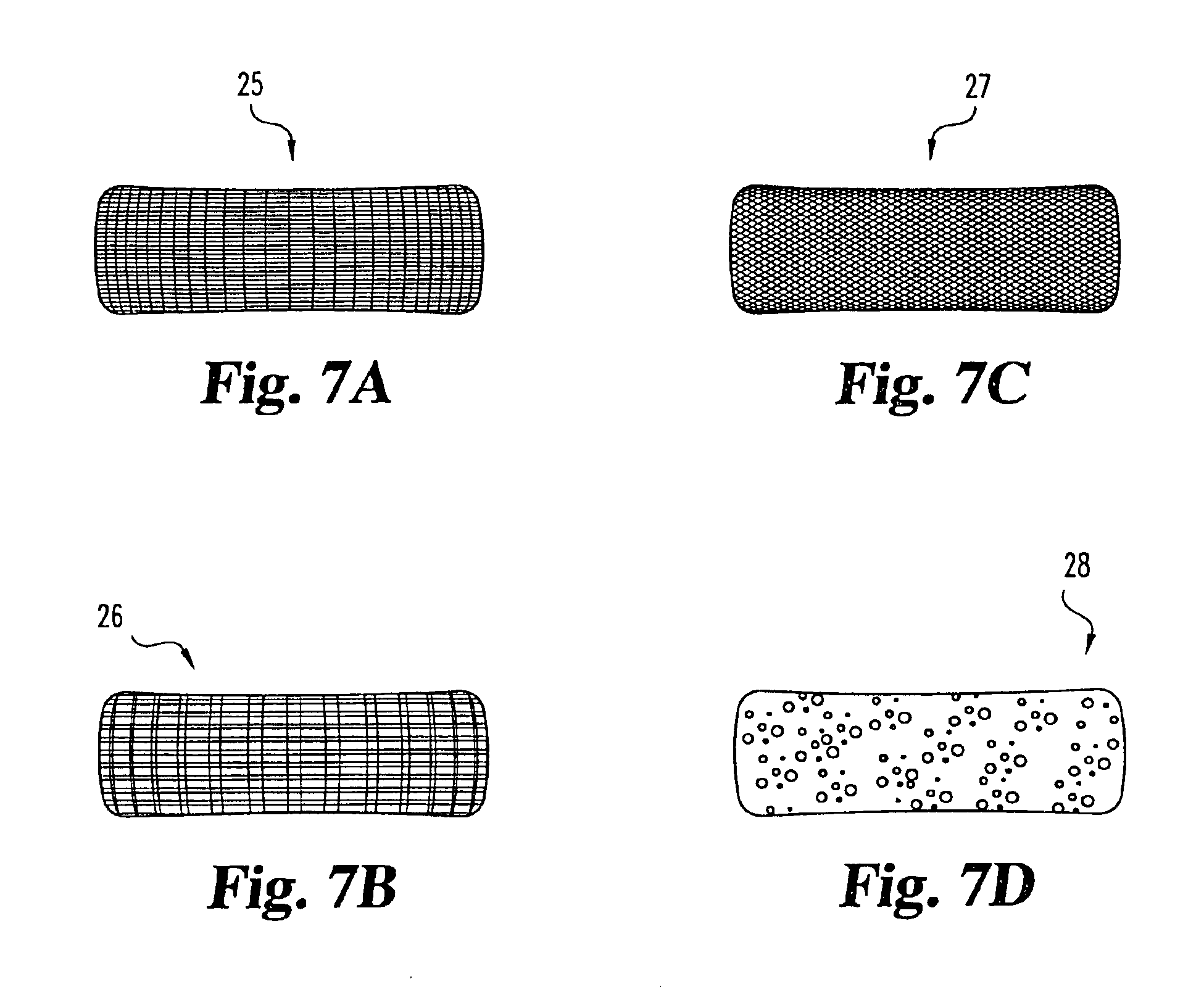 Intervertebral disc nucleus implants and methods