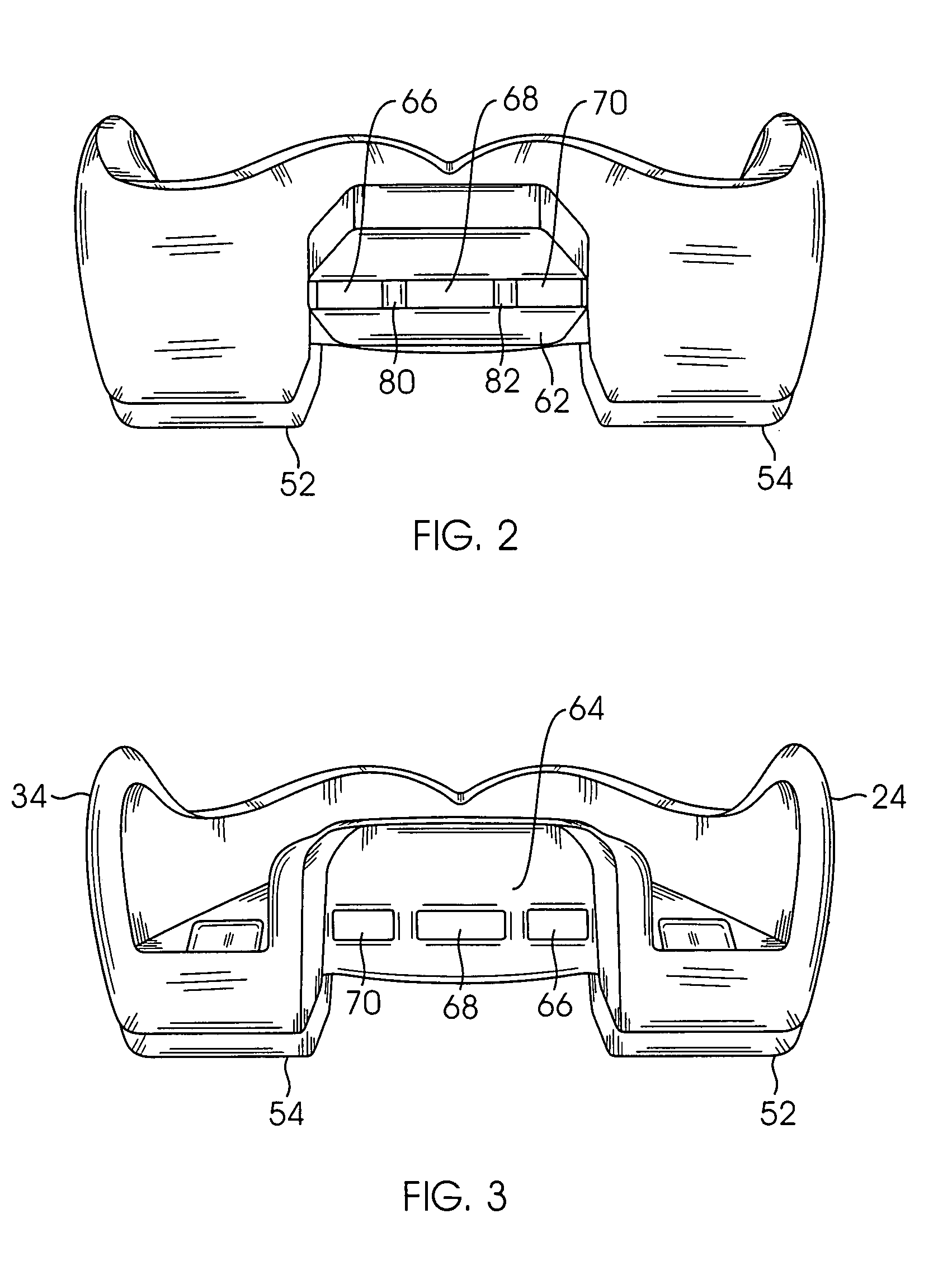 Mouthguard having breathing holes incorporated therein