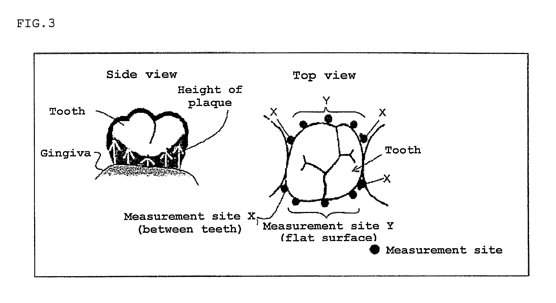 Oral composition