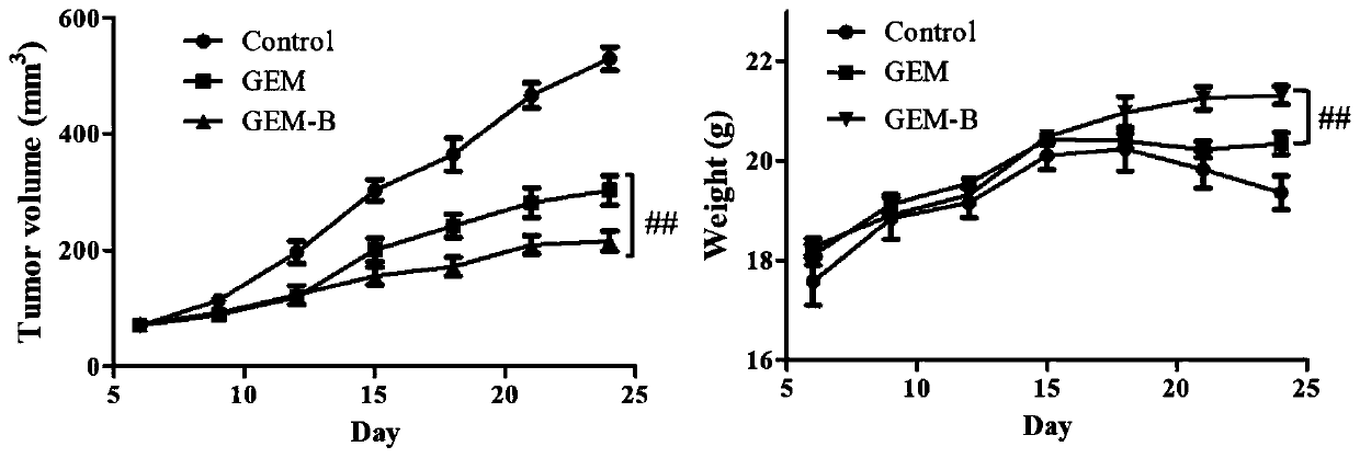 Gemcitabine prodrug with tumor targeting properties and preparation method and application thereof