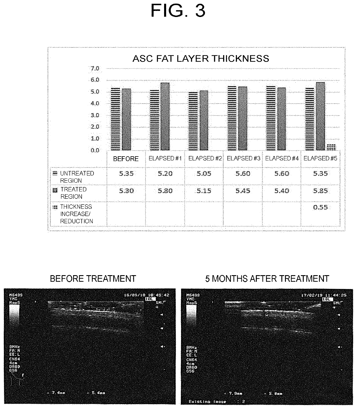 Pharmaceutical composition for use in improving quality of scalp or skin, wound healing, or improving quality of hair