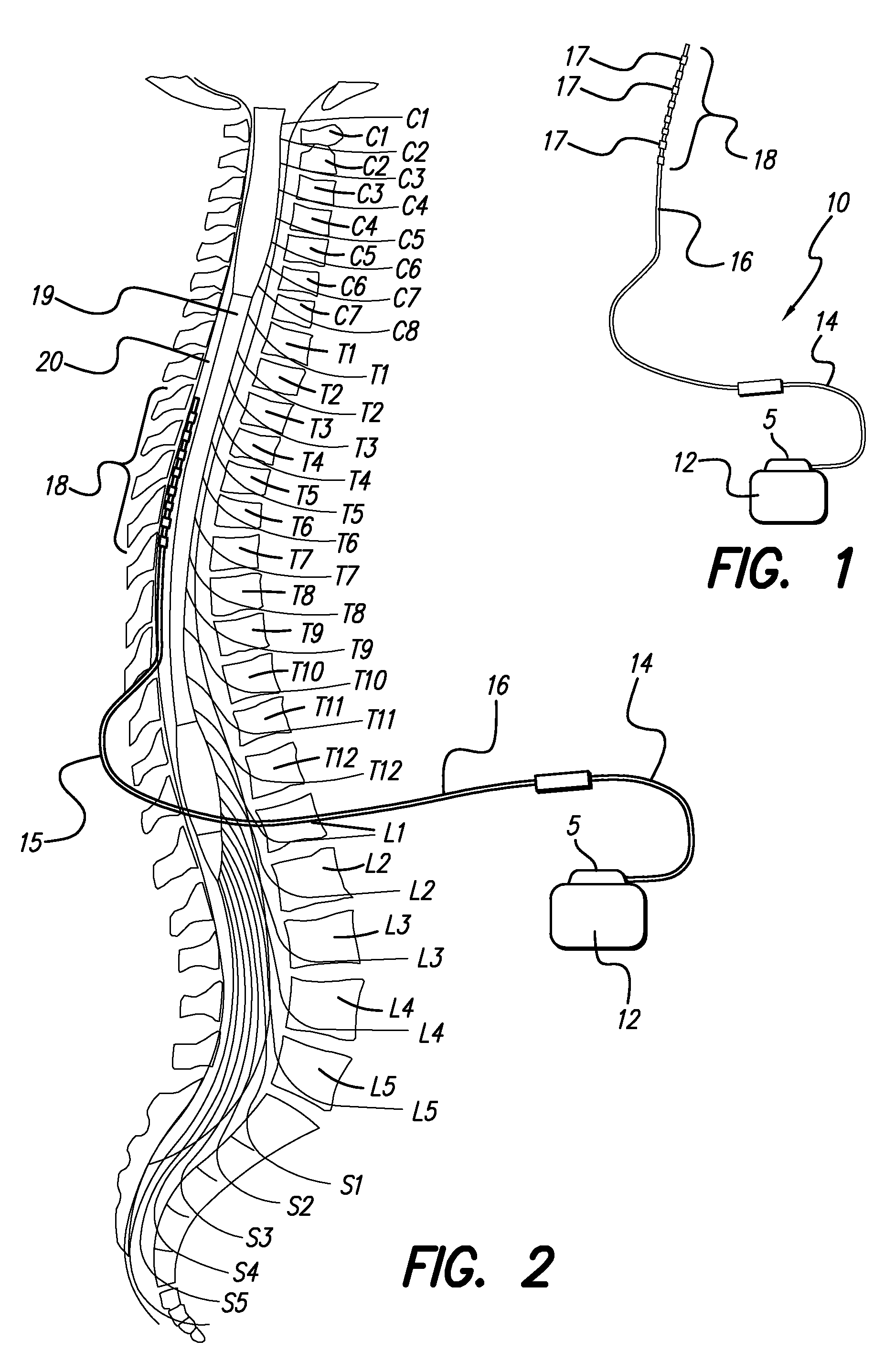 Lead assembly and method of making same