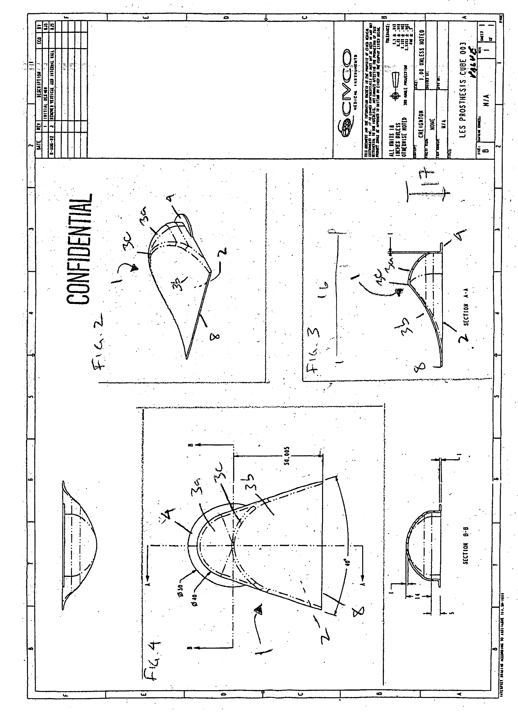 Device and method for treating gastroesophageal reflux disease