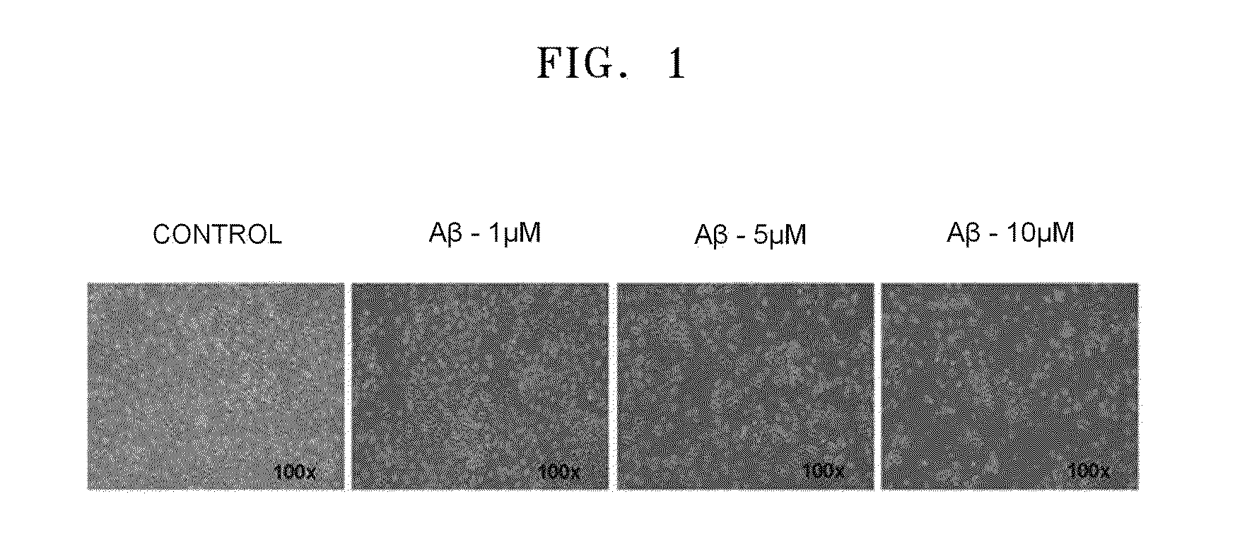 Composition comprising mesenchymal stem cells or culture solution of mesenchymal stem cells for the prevention or treatment of neural diseases