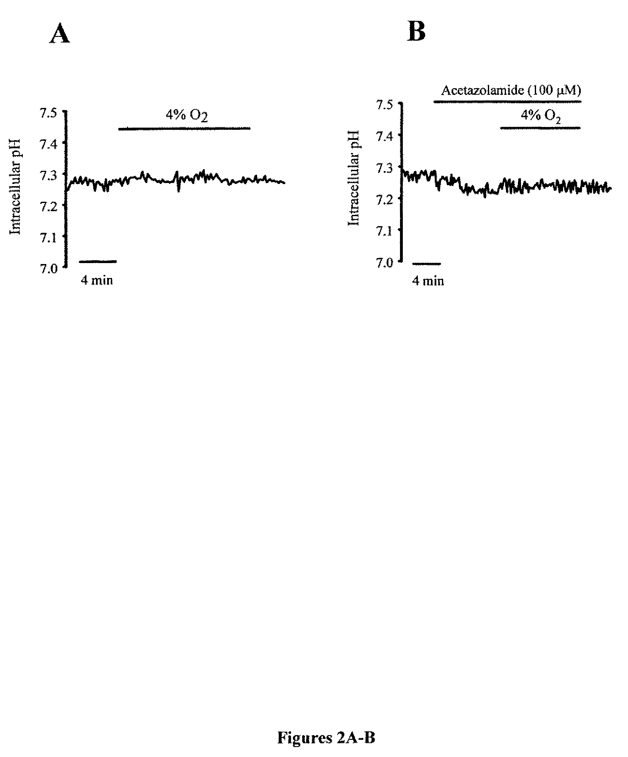 Methods of treating pulmonary disease using acetazolamide and structurally related derivatives