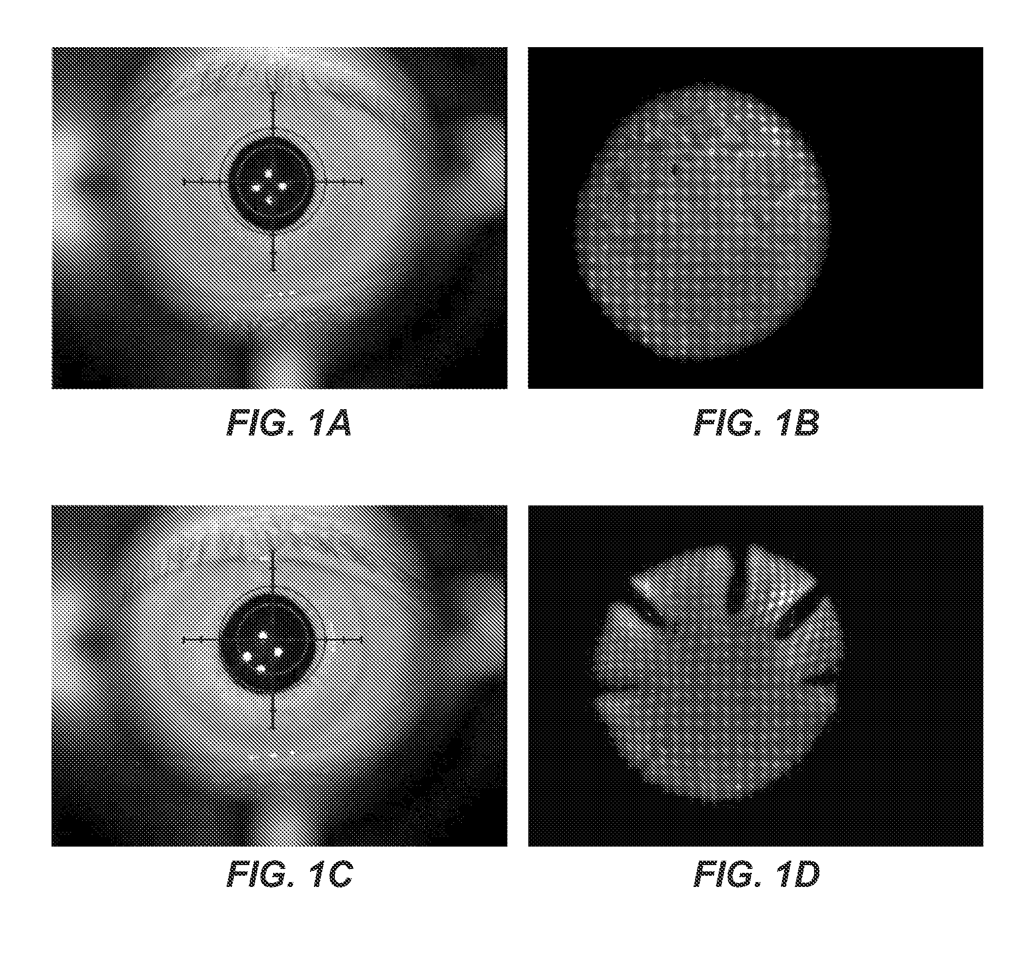 Methods and apparatus for improving vision