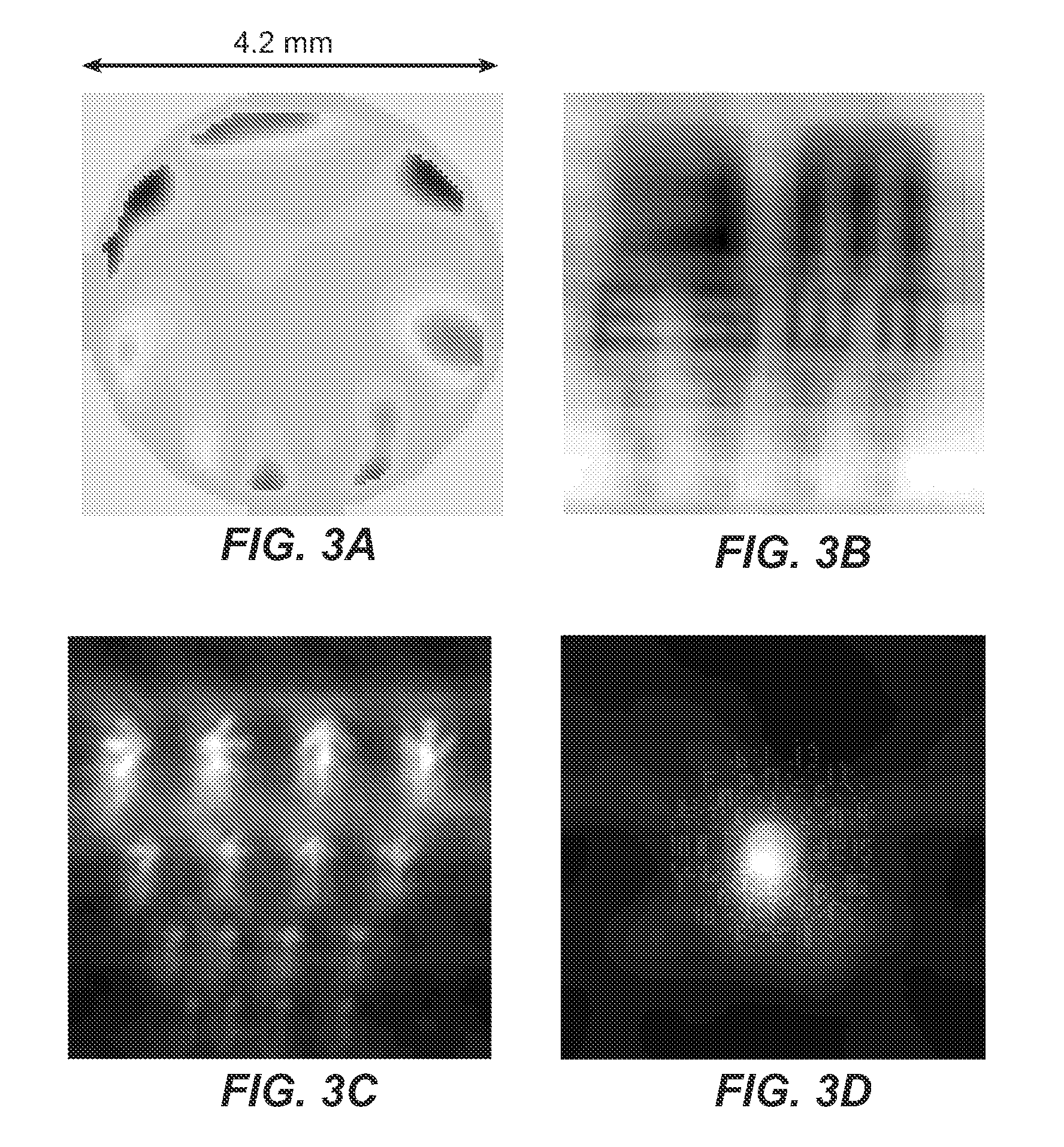 Methods and apparatus for improving vision