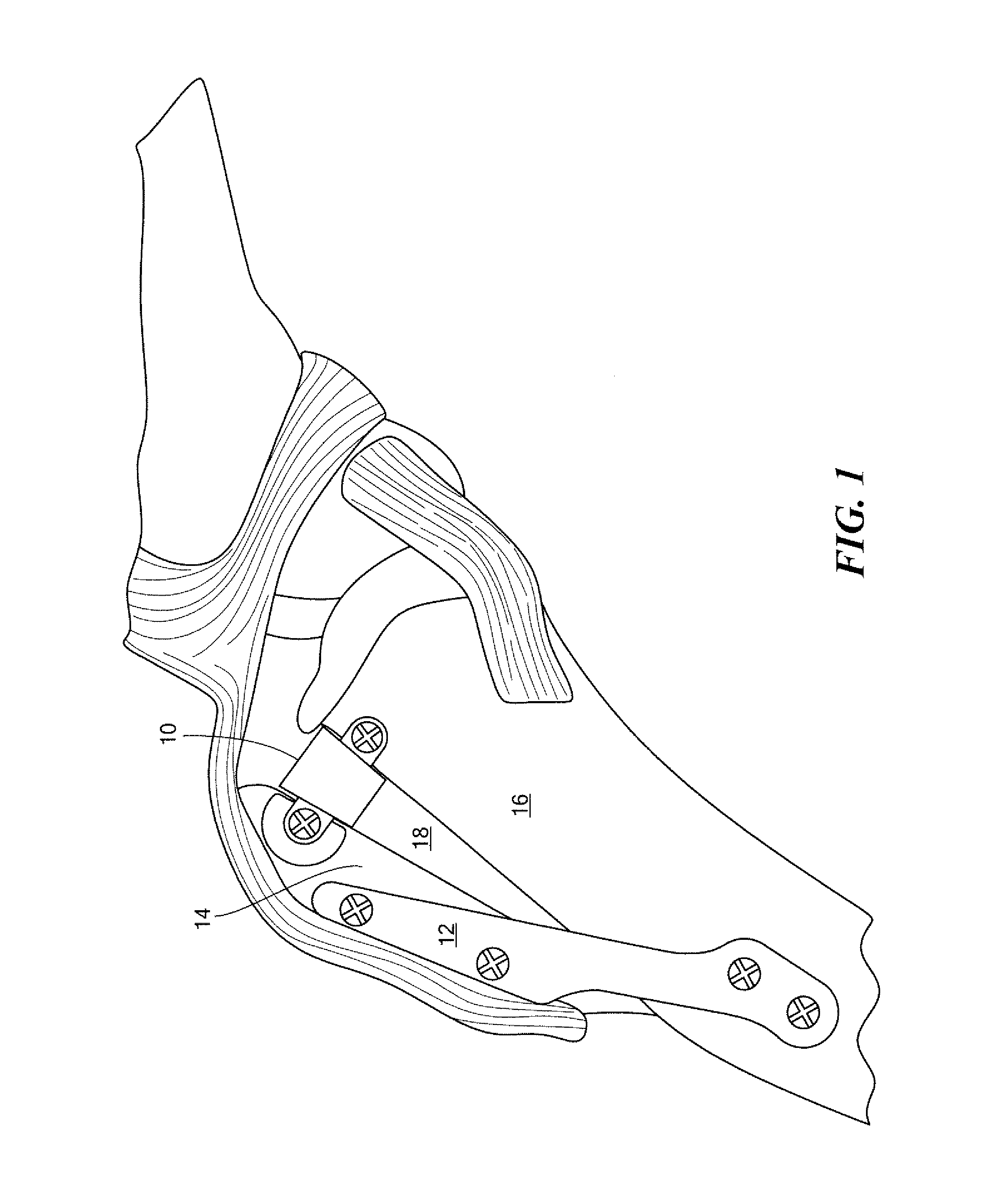 Tibial tuberosity advancement implant