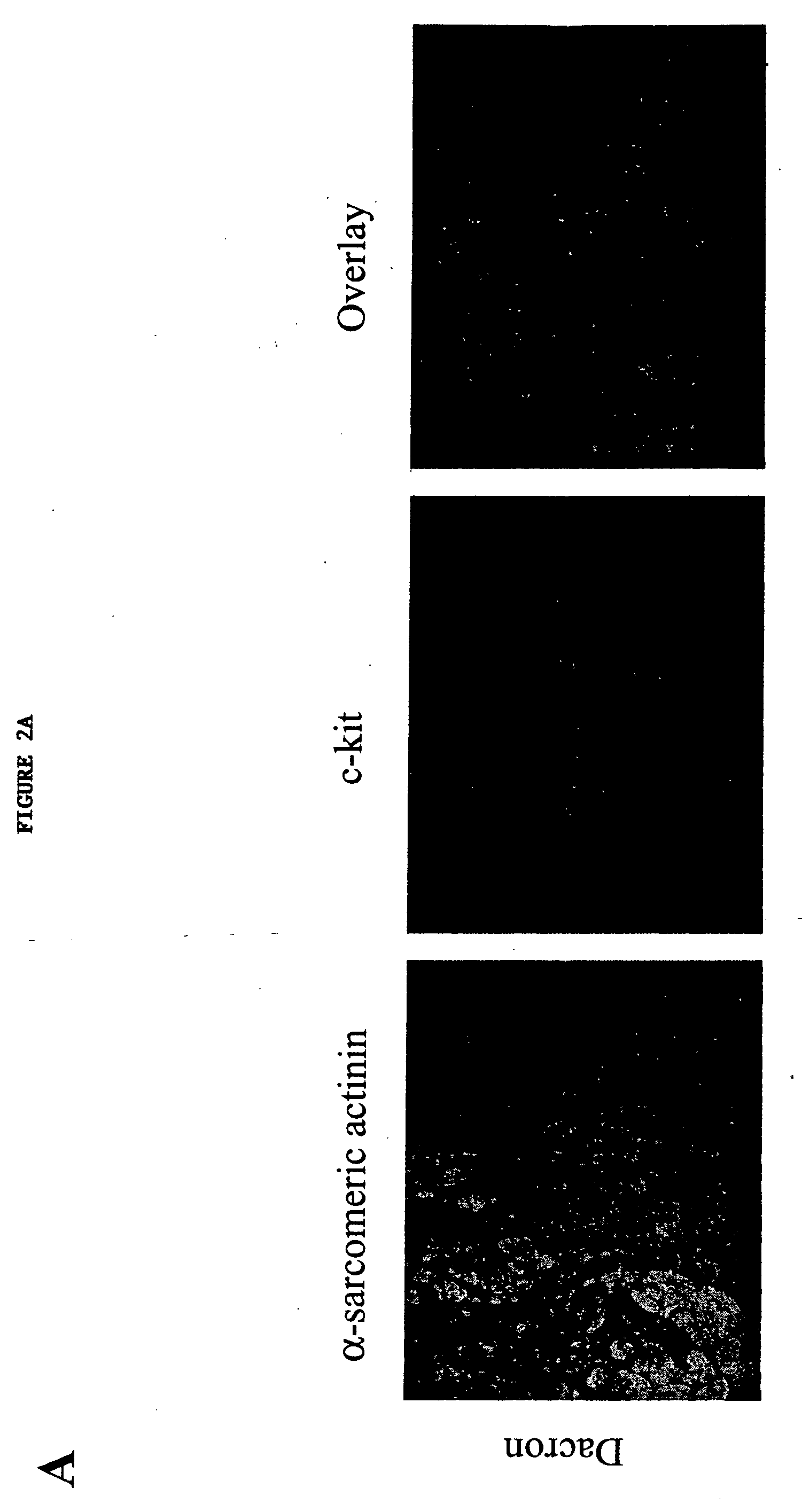 Use of human stem cells and/or factors they produce to promote adult mammalian cardiac repair through cardiomyocyte cell division