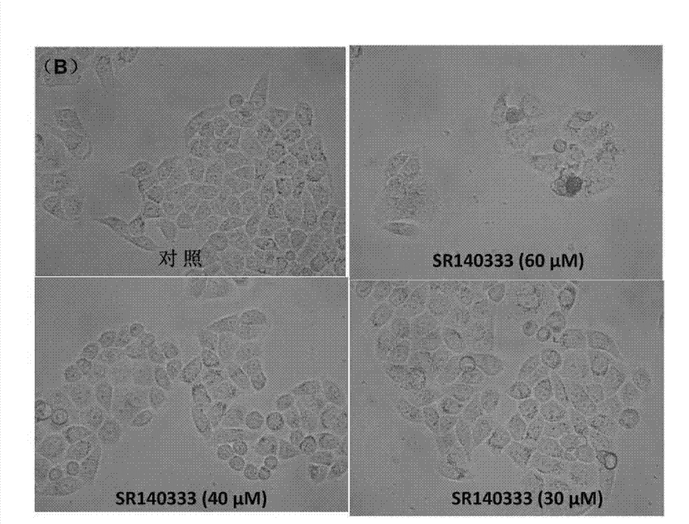 Application of antagonist SR140333 of neurokinin receptor in hepatoma treatment