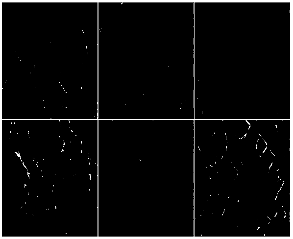 Kadsurae Caulis-loading I/III type collagen composite scaffold