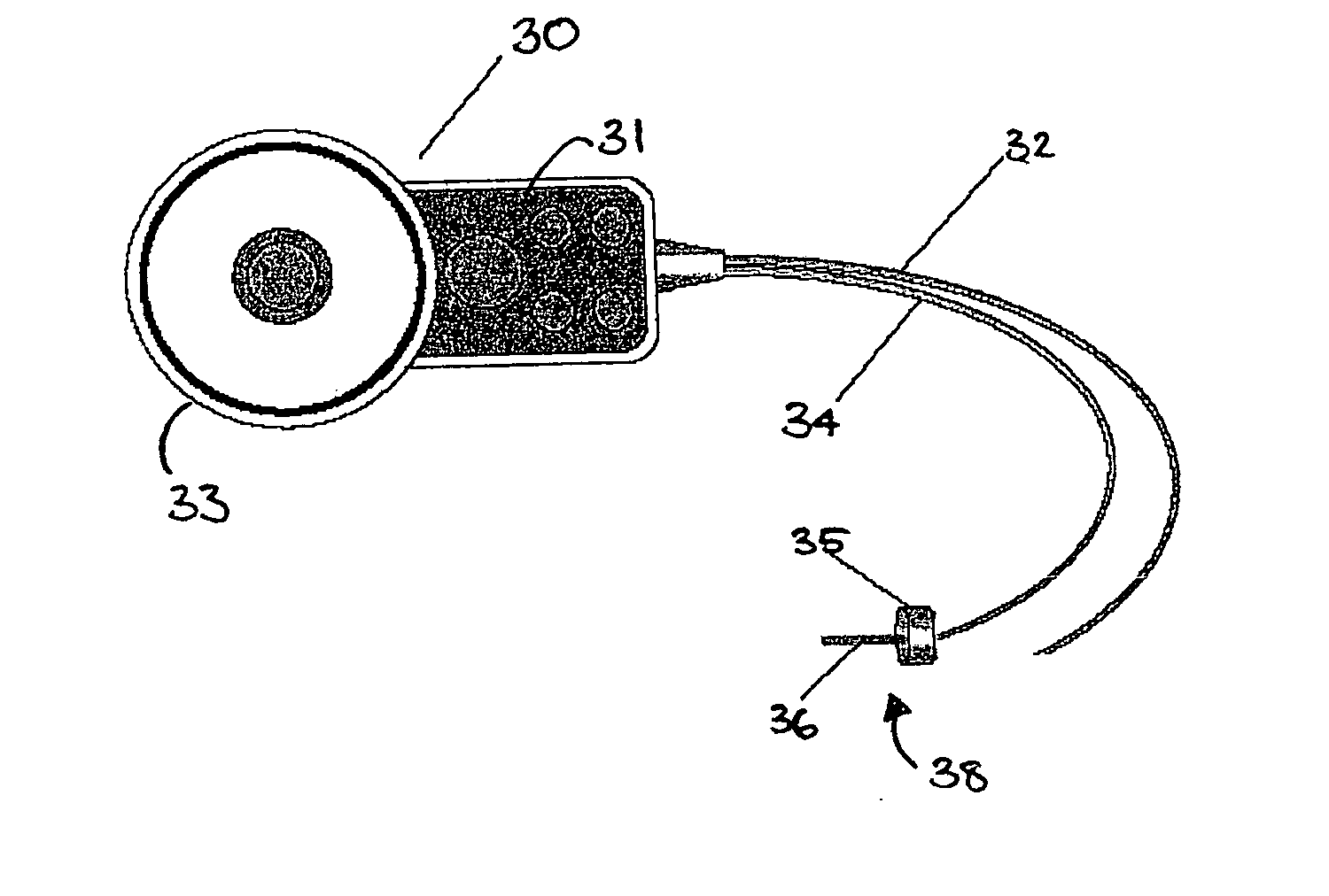 Implantable acoustic sensor