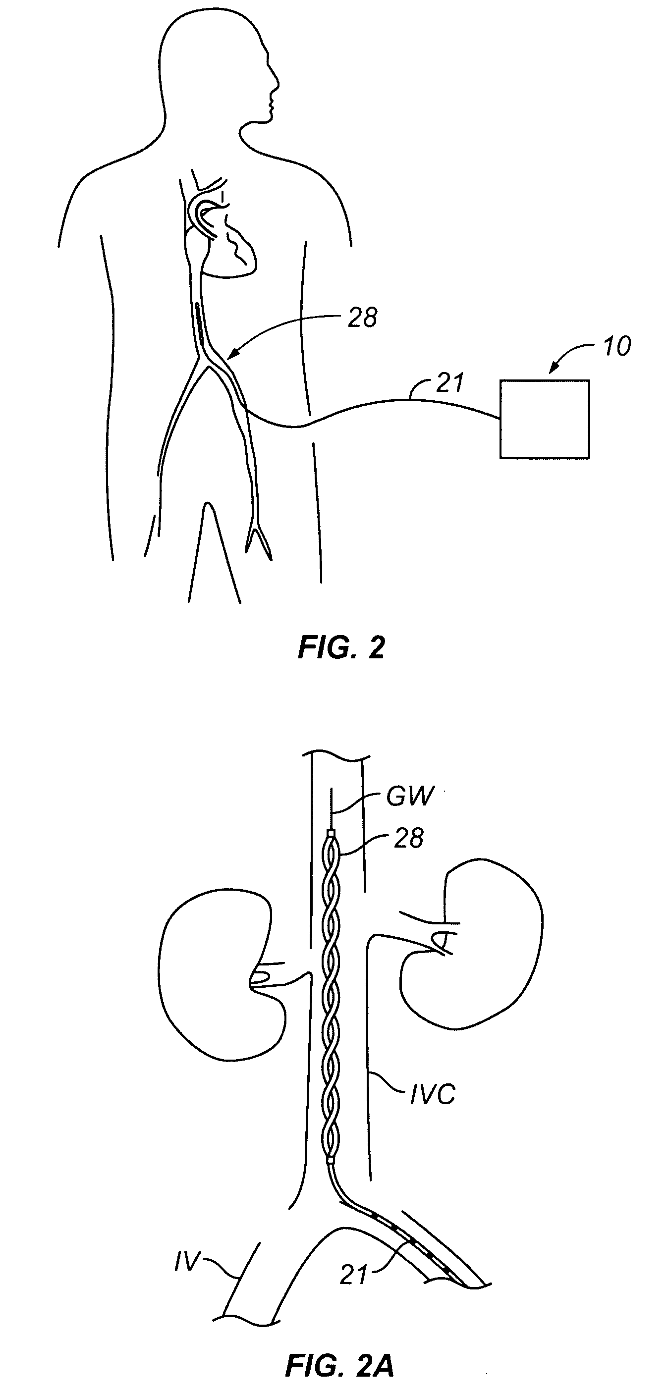 Devices and methods for using endovascular cooling to treat septic shock and other disorders