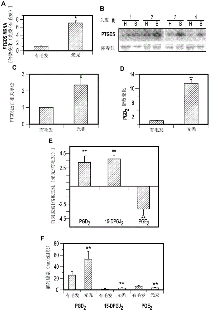 Compositions and methods for regulating hair growth