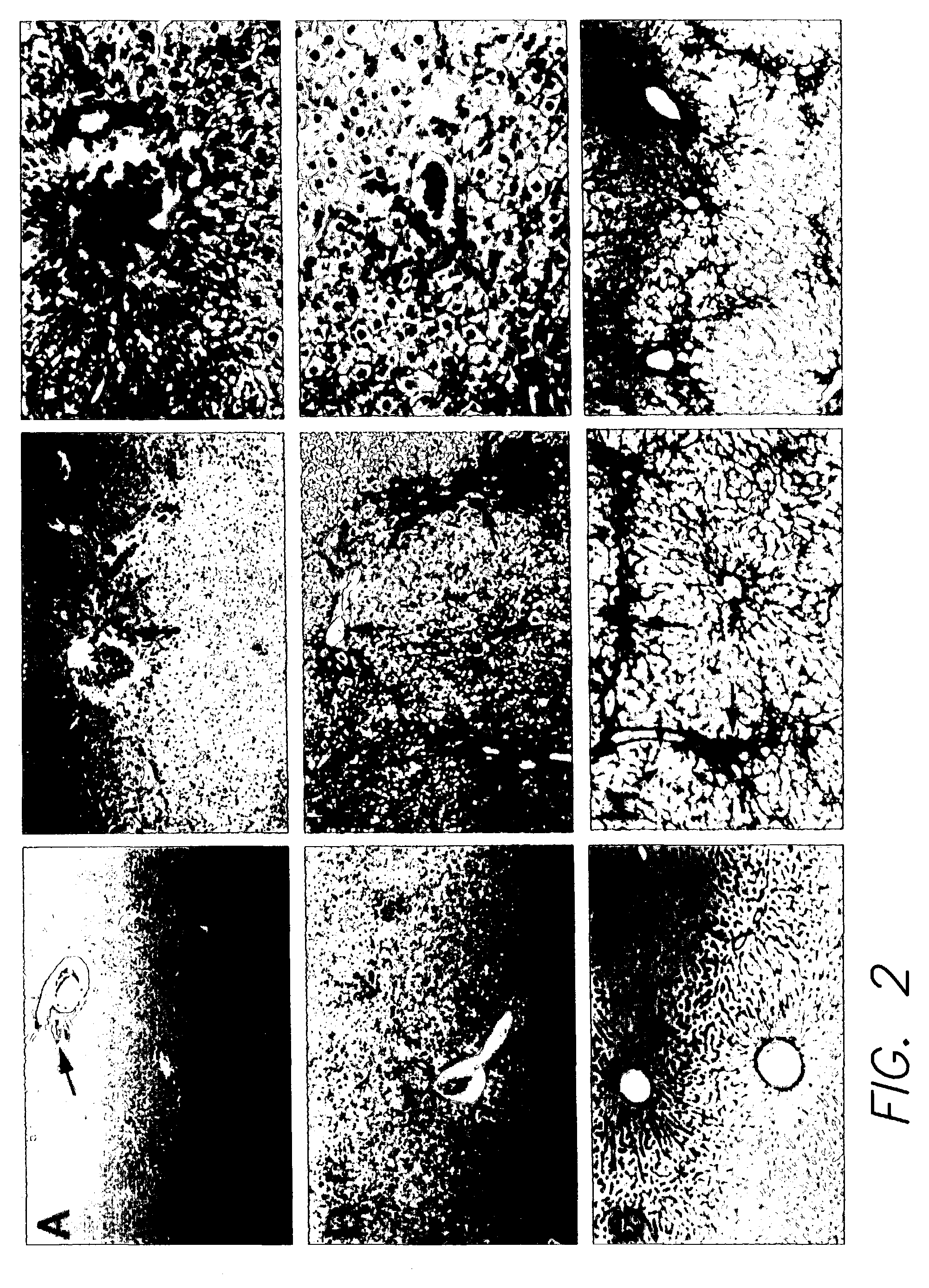 Biological models capable of exhibiting secondary disease manifestations and useful for developing therapeutic drugs, diagnostic products and therapeutic or diagnostic procedures, methods of using same, and cells, tissues and organs derived therefrom