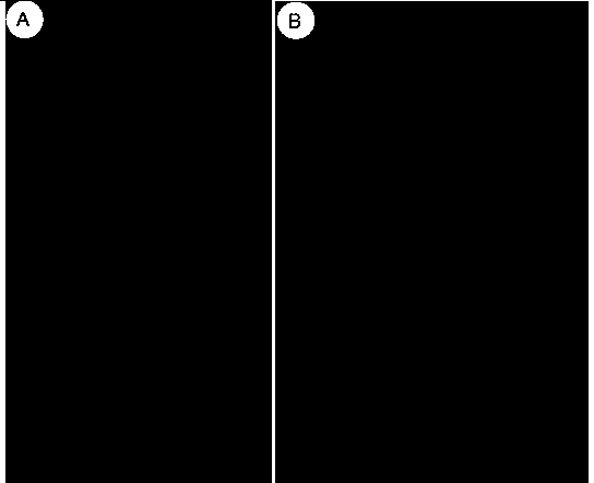 Fusarium oxyxporum f.sp. niveum type strain FON-GFP (Fusarium oxyxporum f.sp. niveum-green fluorescent protein) for expressing GFP as well as preparation method and application of strain