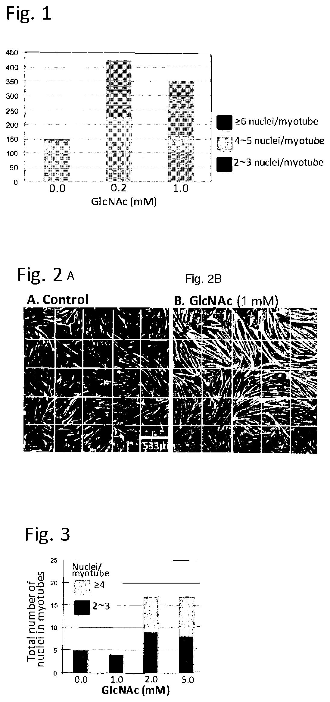 Use of N-acetylglucosamine and derivatives thereof to treat muscle disorders