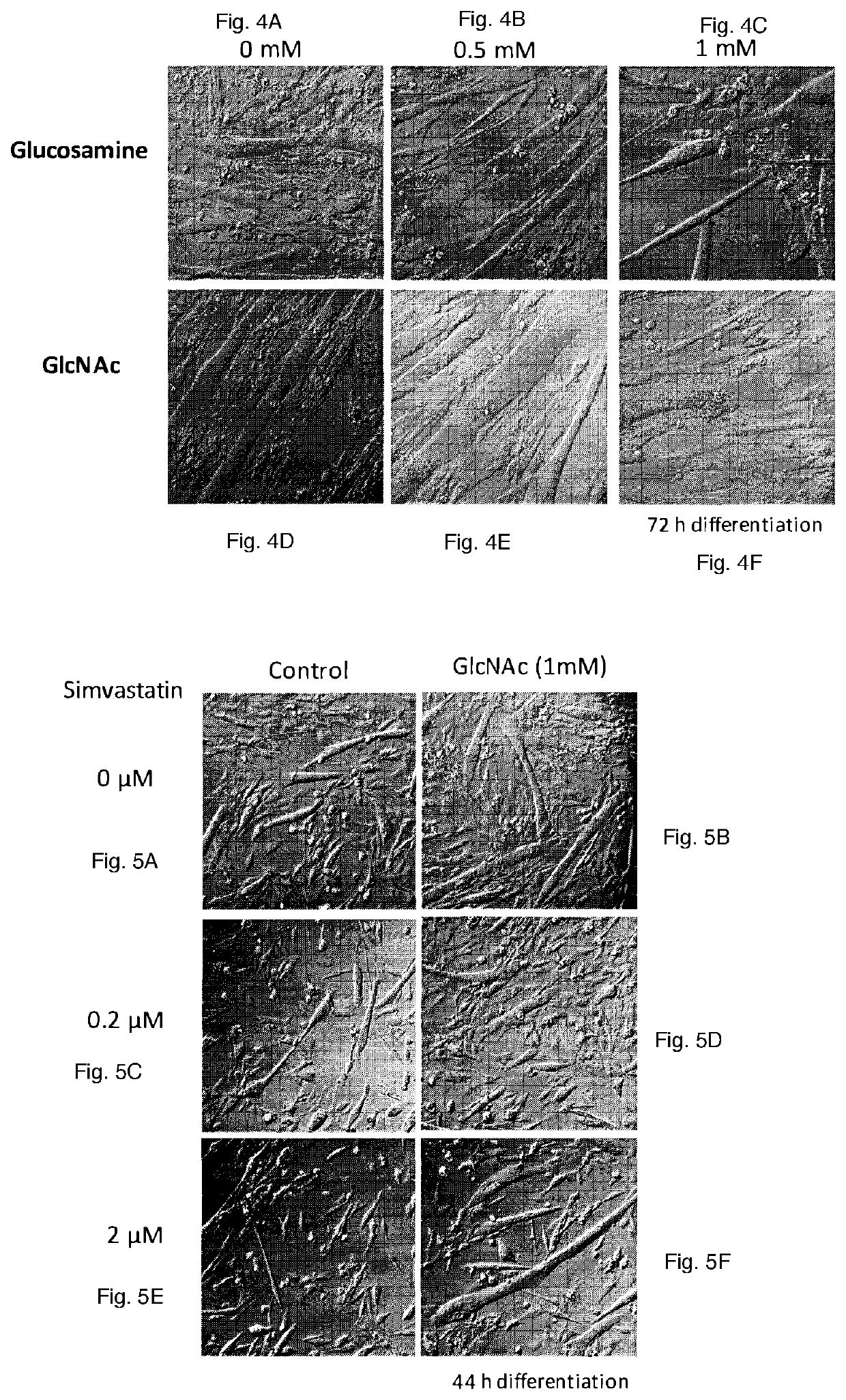 Use of N-acetylglucosamine and derivatives thereof to treat muscle disorders