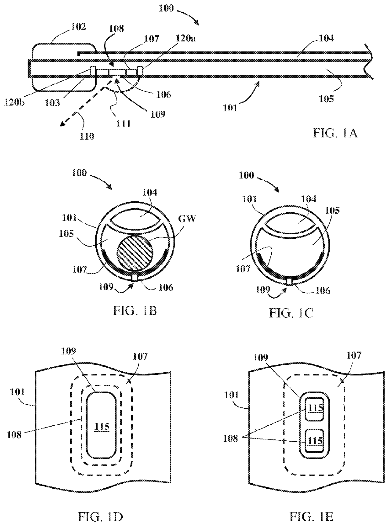 Balloon catheter with fortified proximal outlet port, and manufacturing thereof