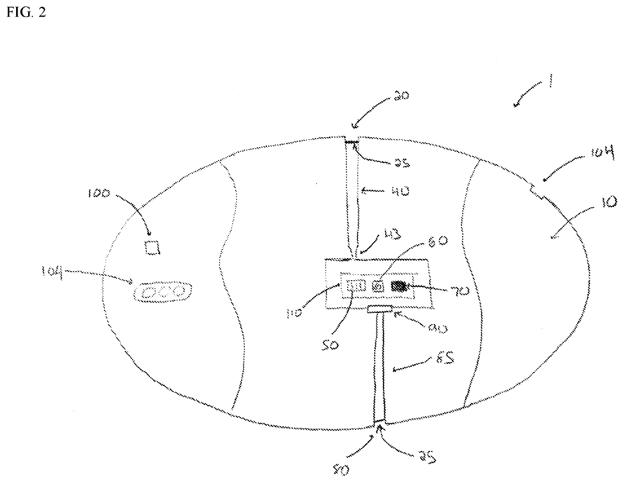 Non-invasive monitoring system