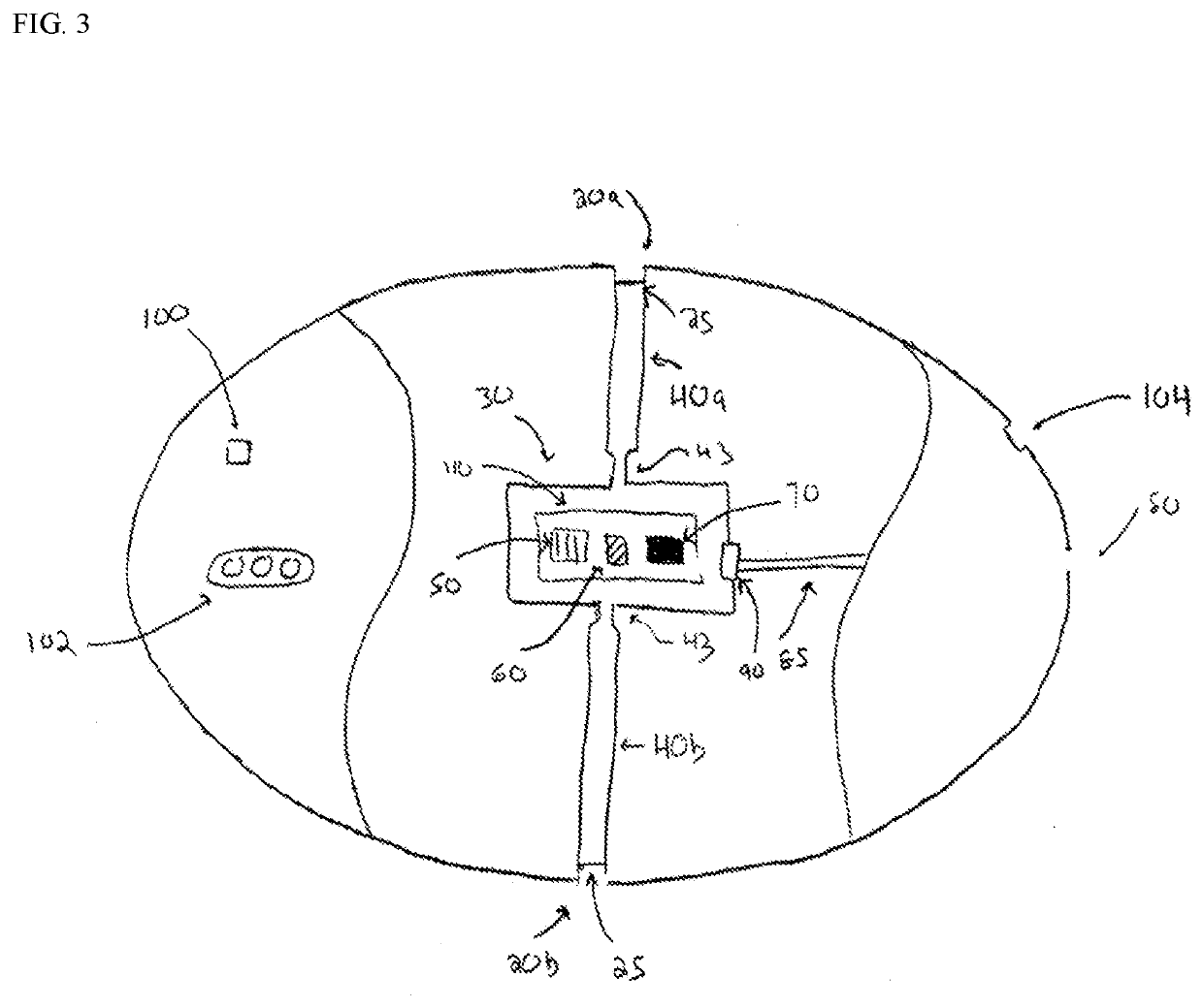 Non-invasive monitoring system