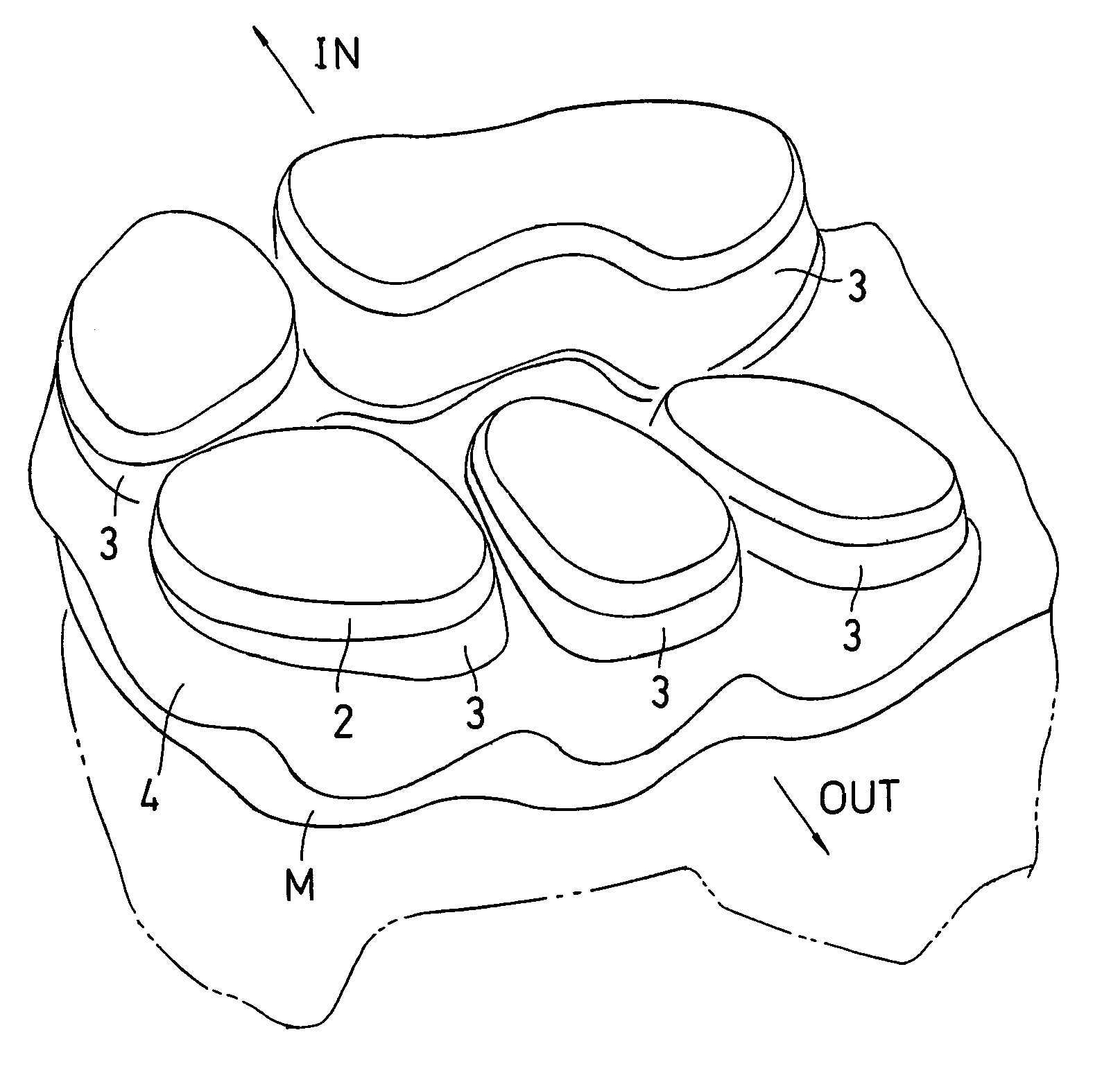 Shock absorbing device for shoe sole in rear foot part