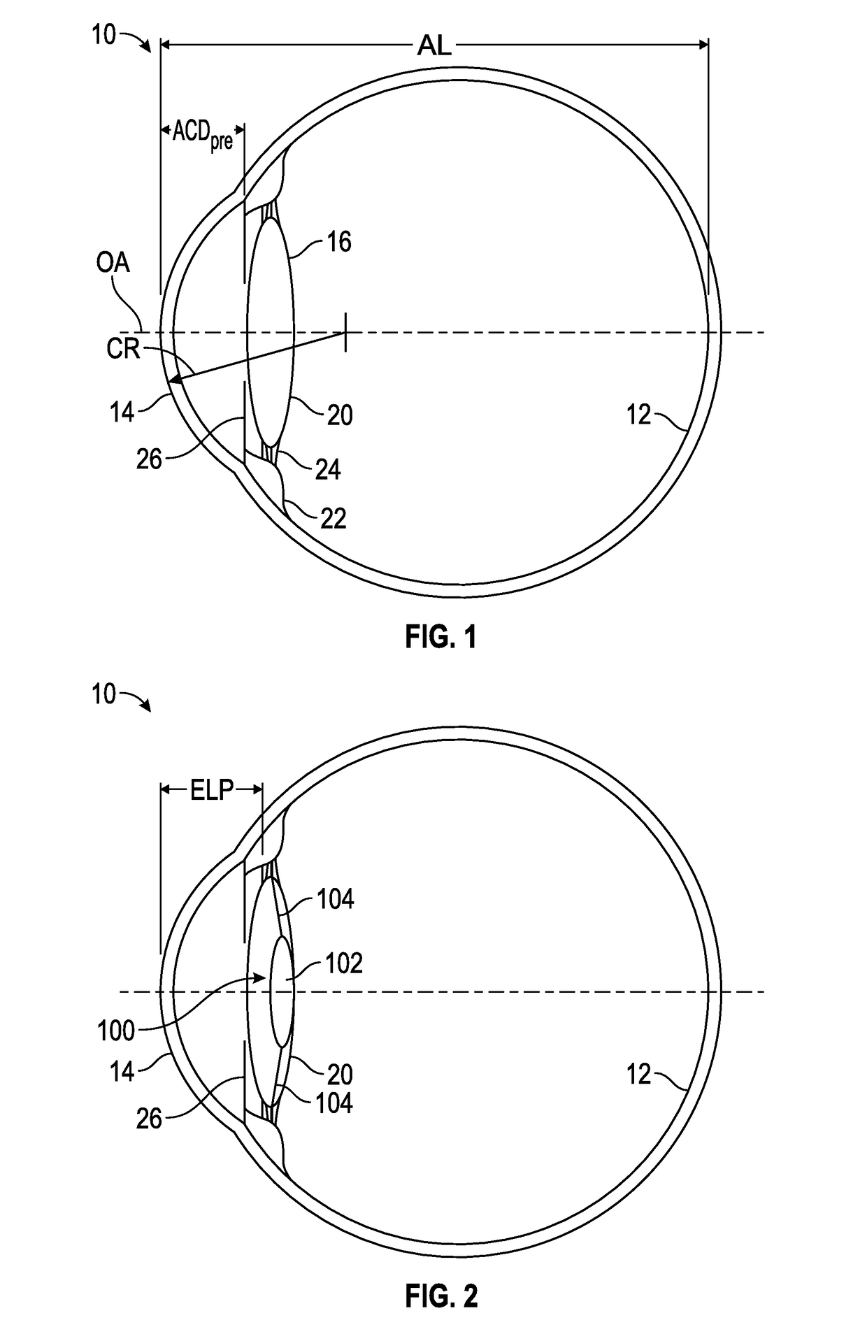 Ophthalmic devices that improve peripheral vision