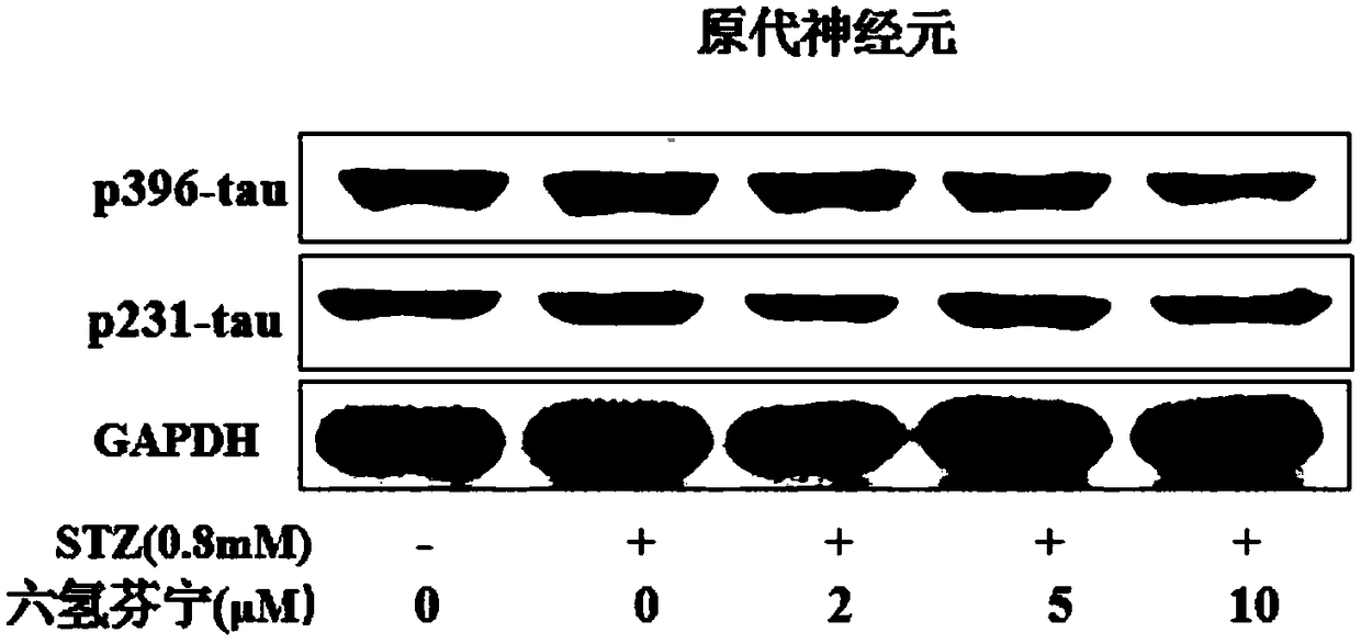 Application of hexahydroadiphenine and pharmaceutically acceptable salts thereof in preparation of medicines for treating Alzheimer disease