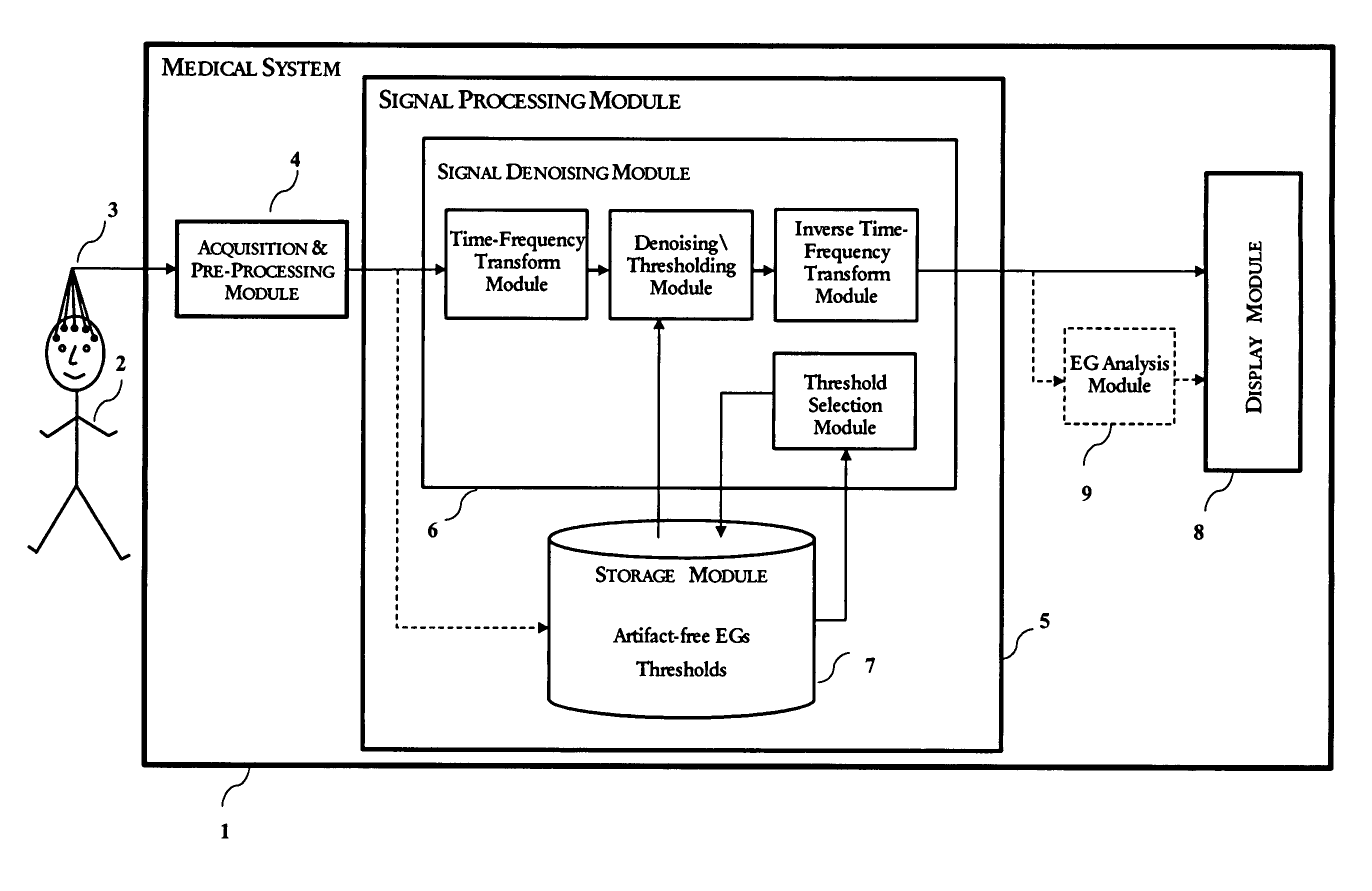 Method and system for the denoising of large-amplitude artifacts in electrograms using time-frequency transforms