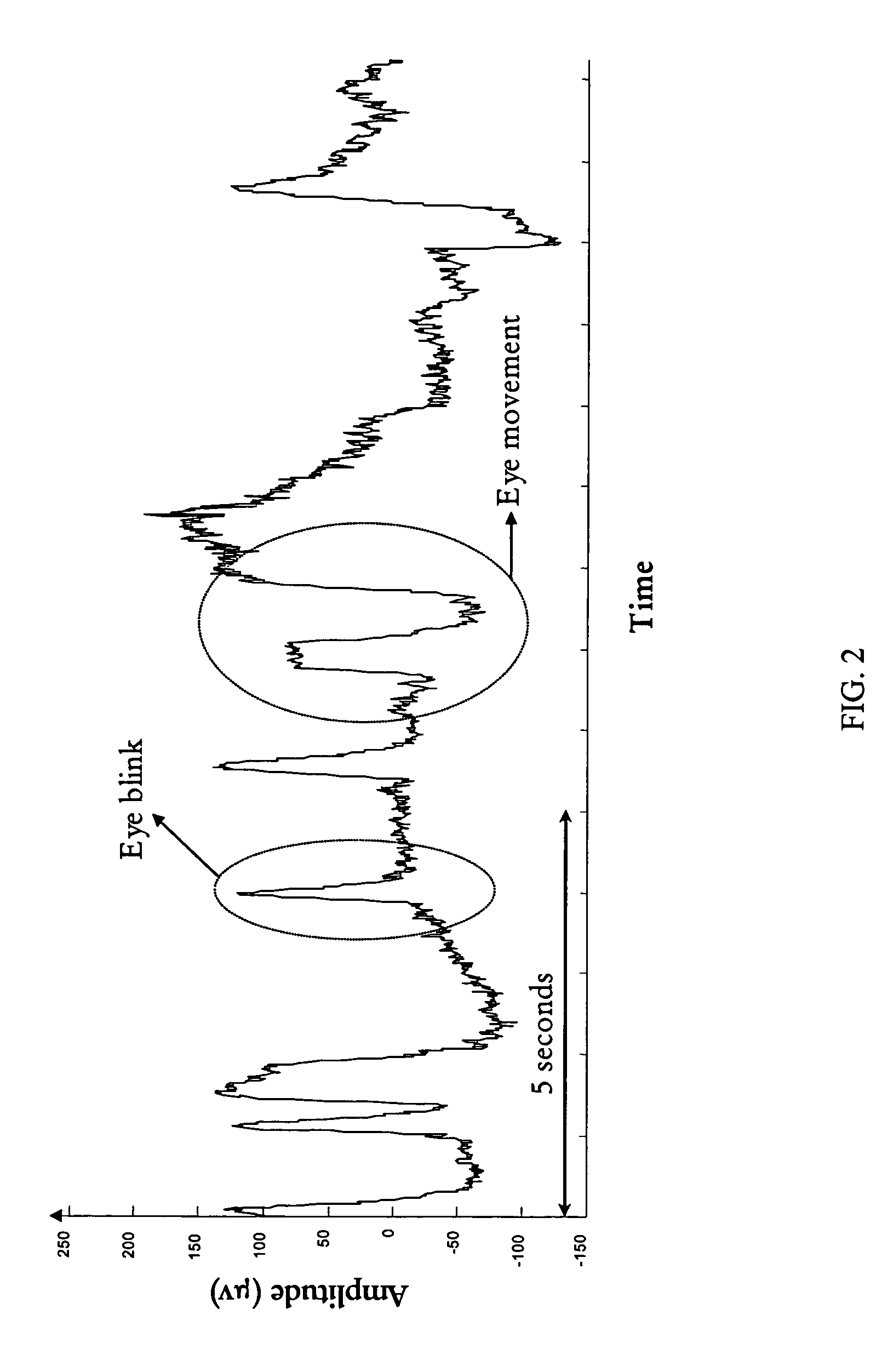 Method and system for the denoising of large-amplitude artifacts in electrograms using time-frequency transforms