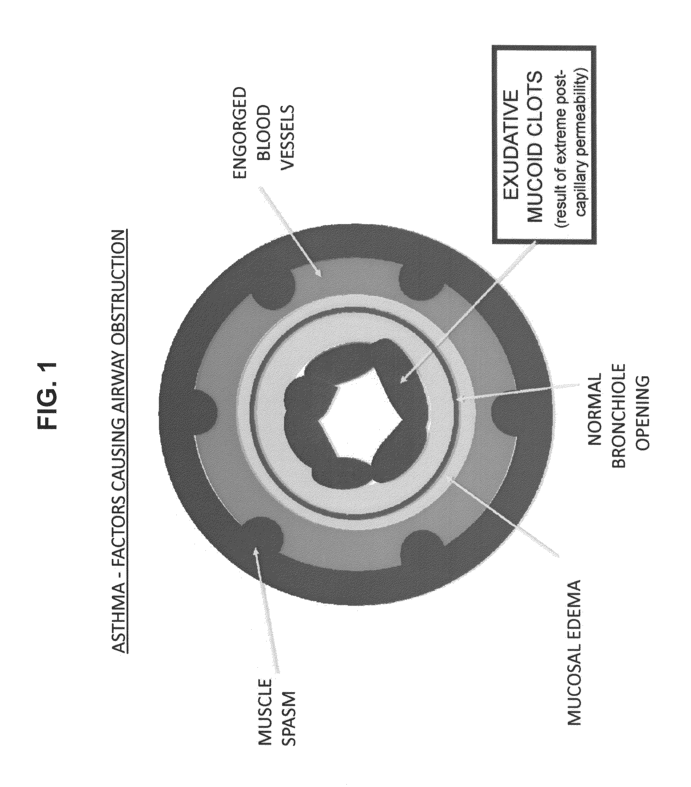 Compositions and methods for treatment of diseases and conditions with increased vascular permeability