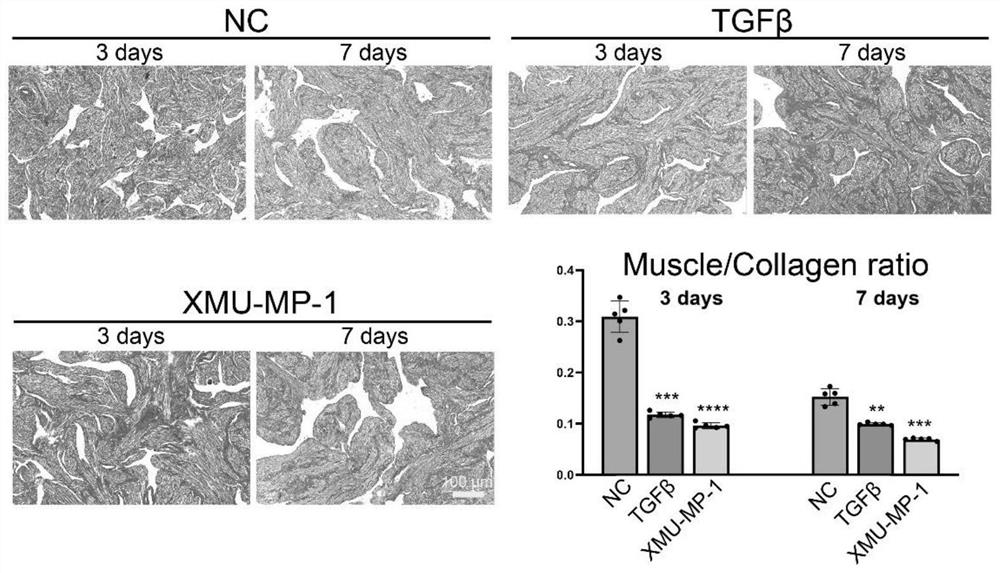 Method for establishing cavernous body fibrosis disease model