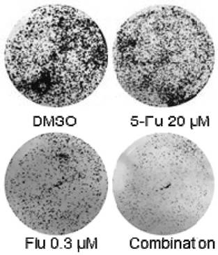 A pharmaceutical composition and its application in the preparation of antitumor drugs