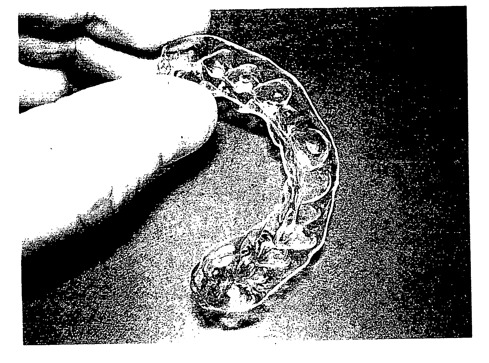 Orthodontic system