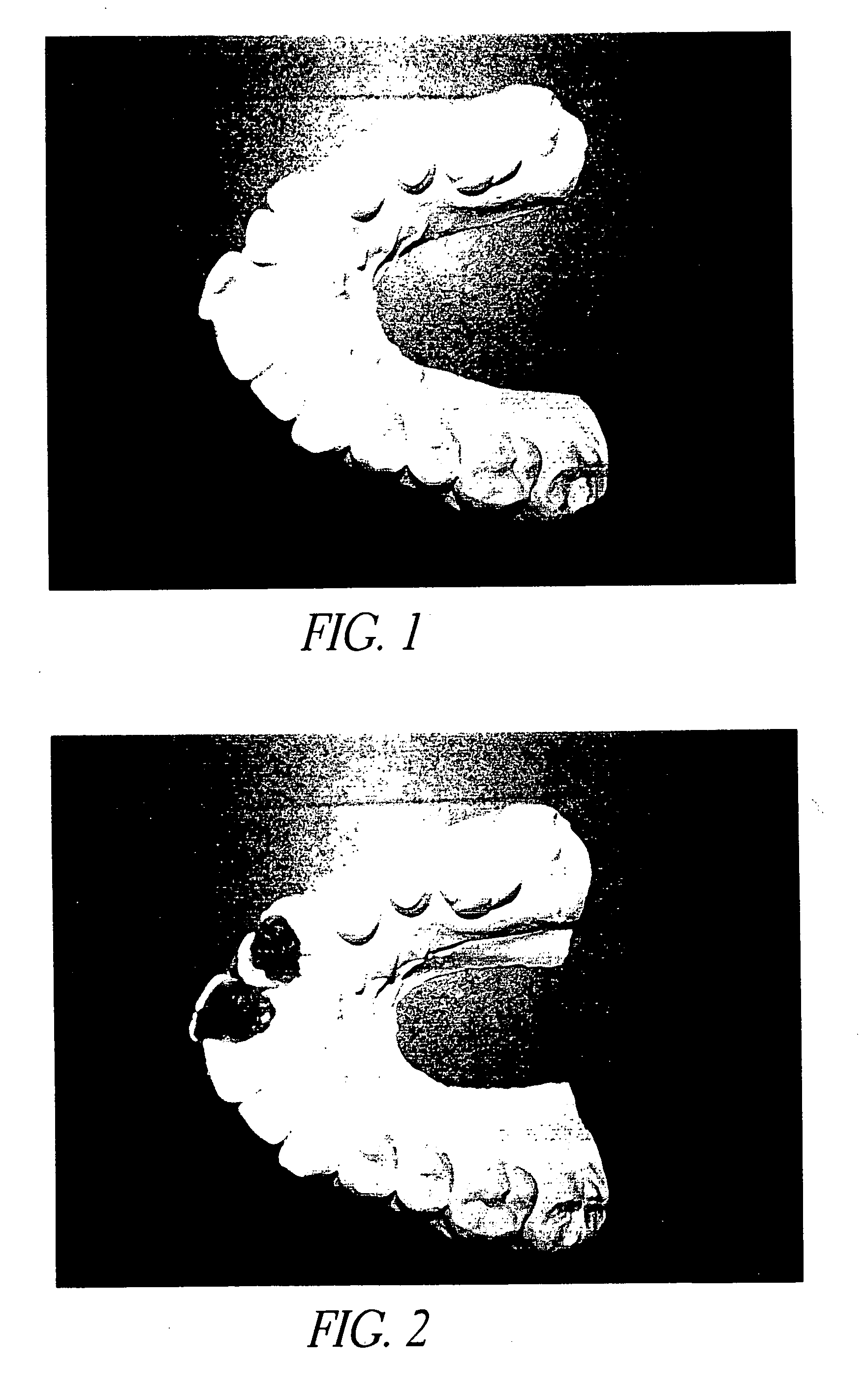 Orthodontic system