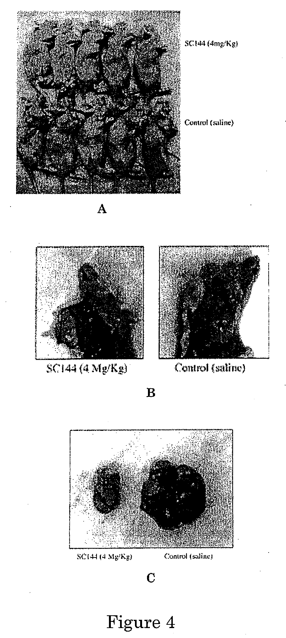 Novel compounds for treatment of cancer and disorders associated with angiogenesis function