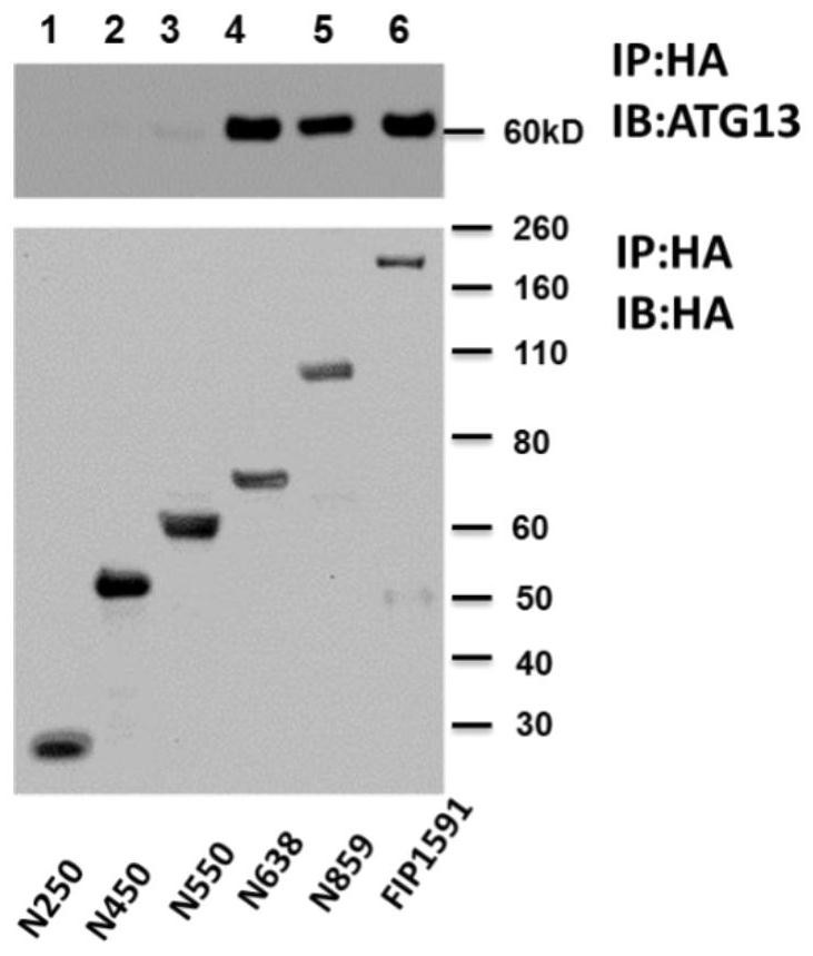 A kind of autophagy inhibitory polypeptide