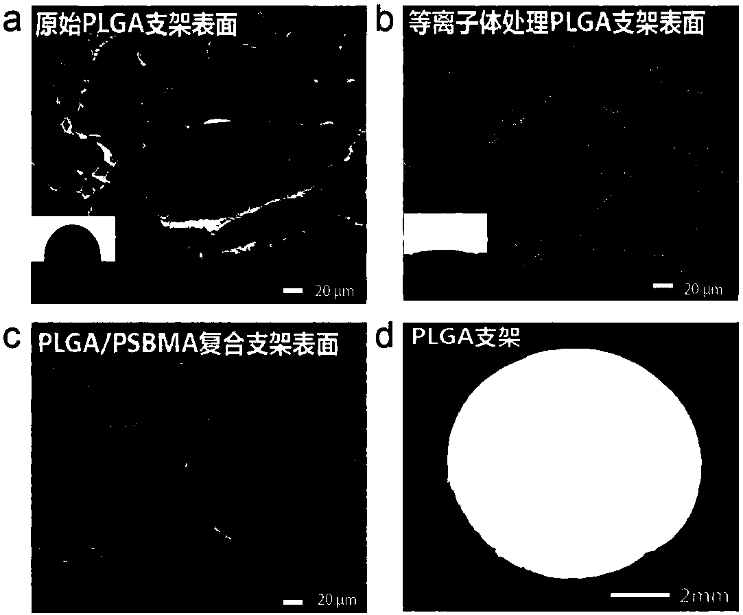 PLGA/zwitterionic composite porous bone tissue engineering scaffold and preparation method thereof