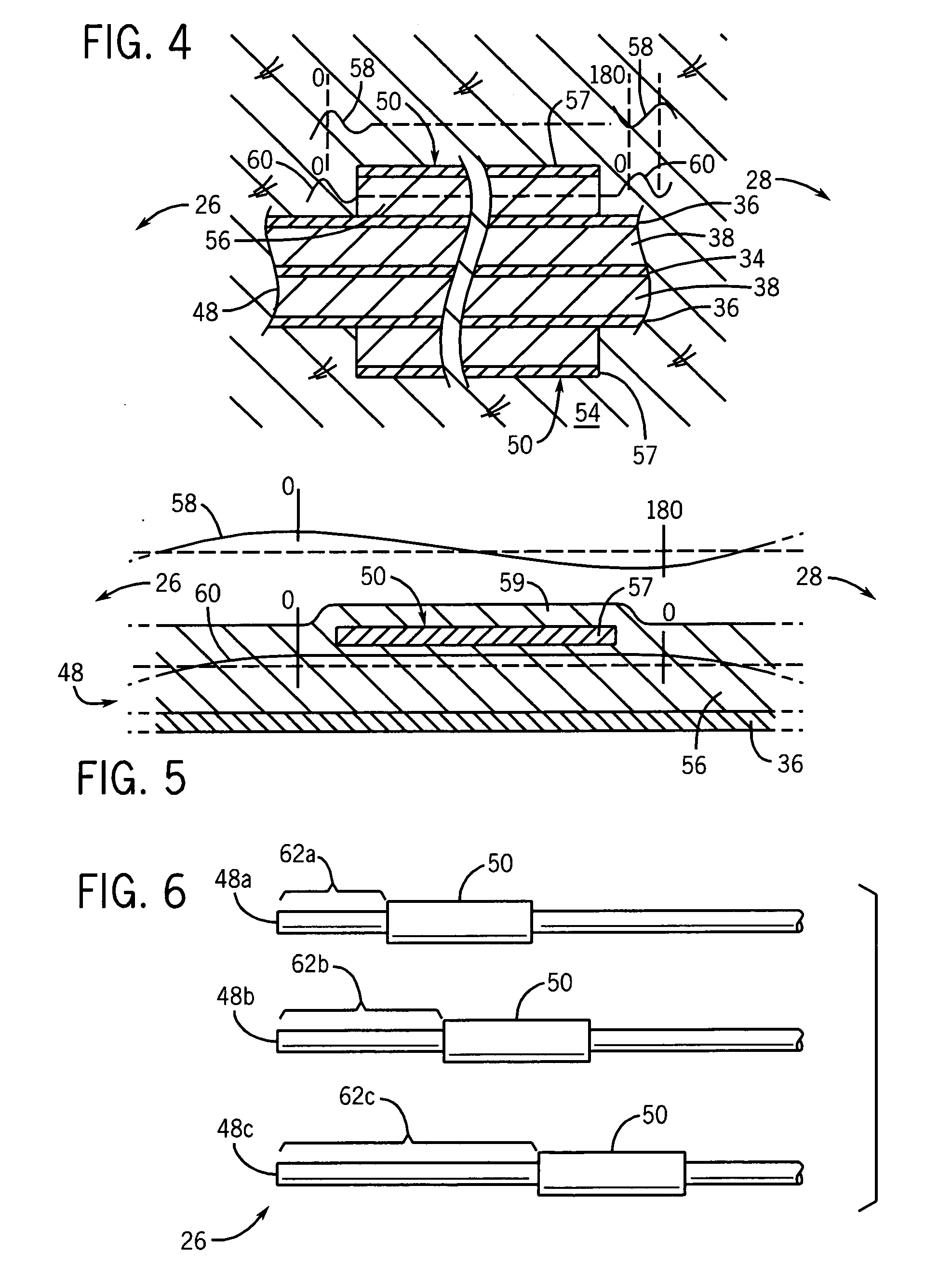 Floating sleeve microwave antenna for tumor ablation