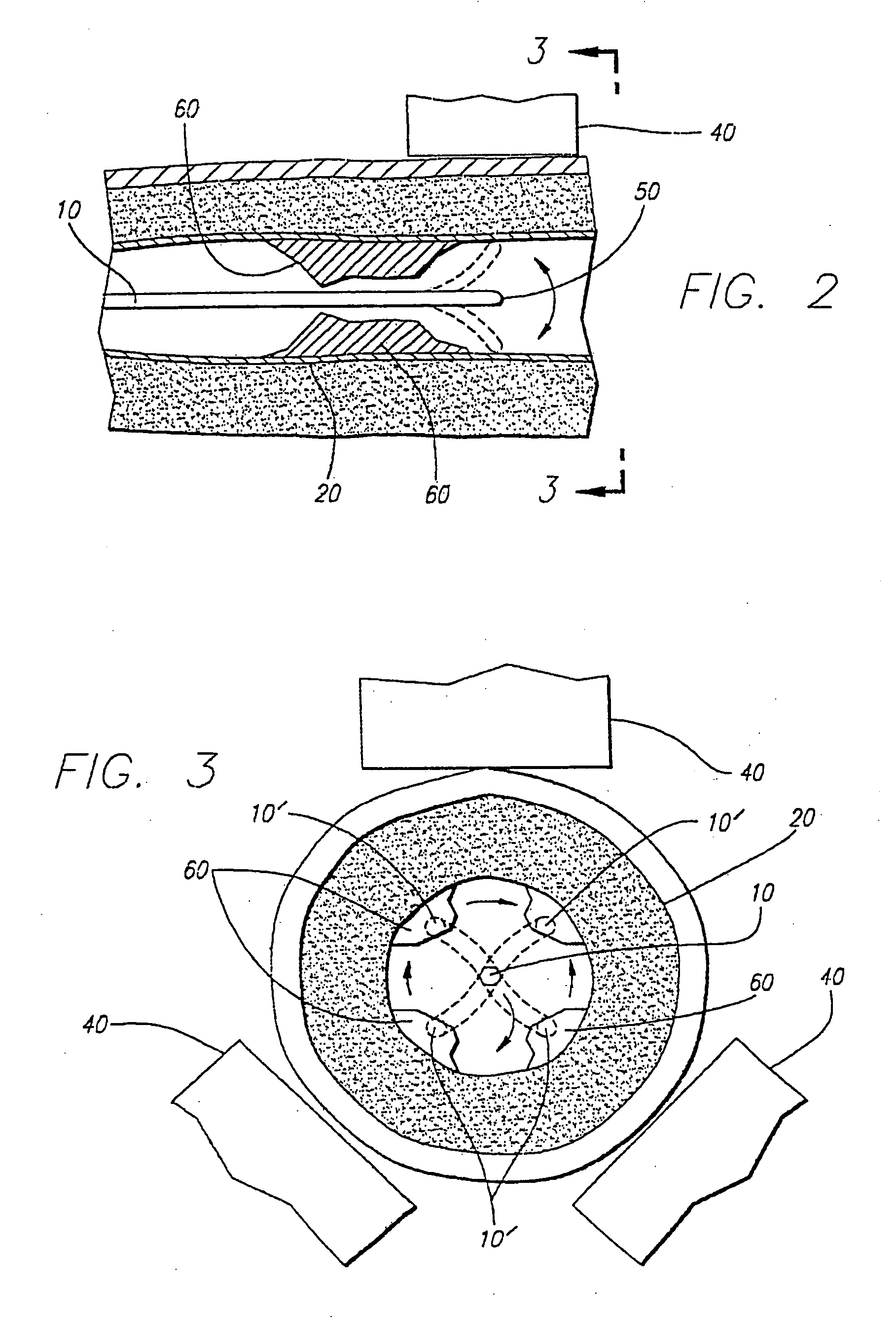 Apparatus and method for inducing vibrations in a living body