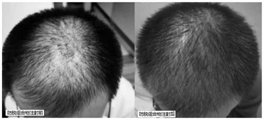 Anti-hair loss repair composition and application