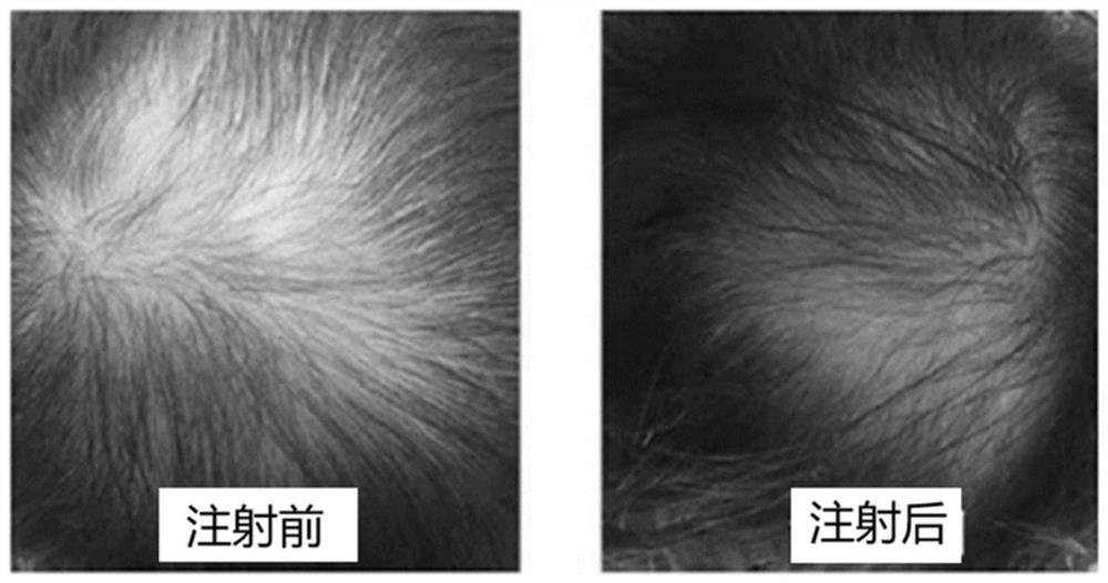 Anti-hair loss repair composition and application