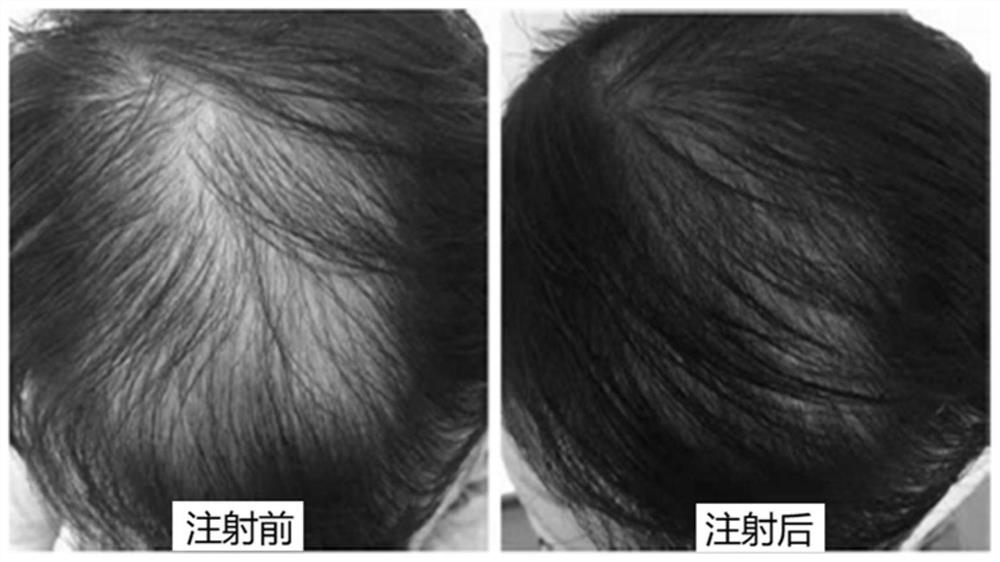 Anti-hair loss repair composition and application