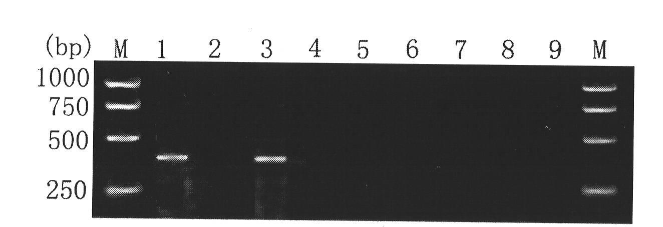 Kit for detecting fasciola hepatica by using PCR specificity