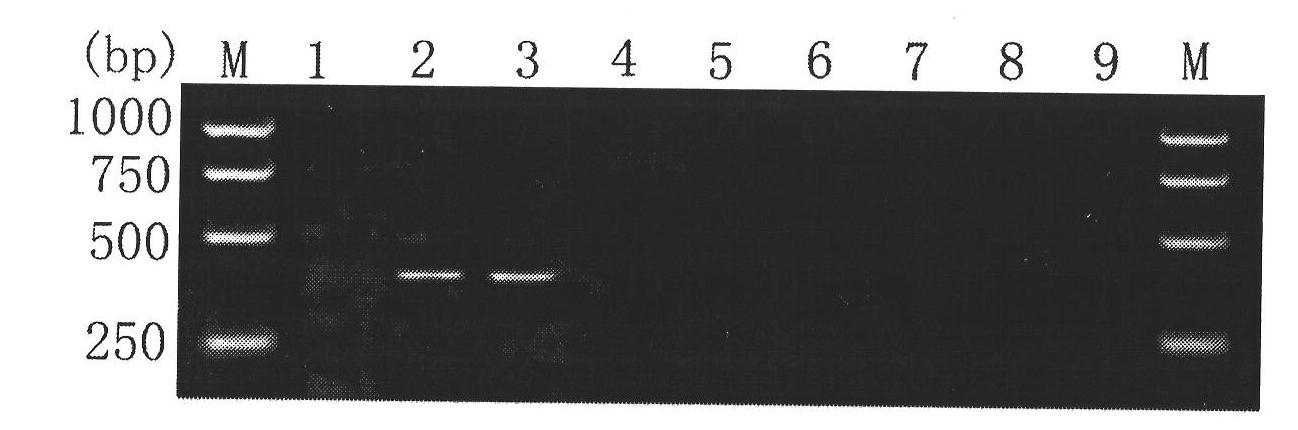 Kit for detecting fasciola hepatica by using PCR specificity