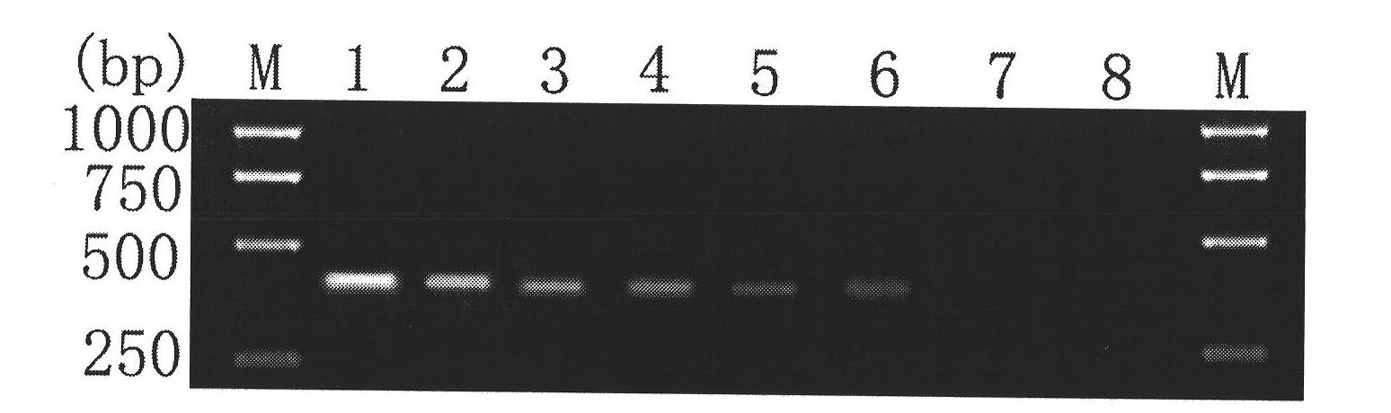 Kit for detecting fasciola hepatica by using PCR specificity